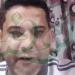 43 يومًا داخل حضّانة.. ودواء من السوق السوداء.. أب يتهم"صحة البحر الأحمر " بالتسبب  في إصابة طفلته بالعمى»